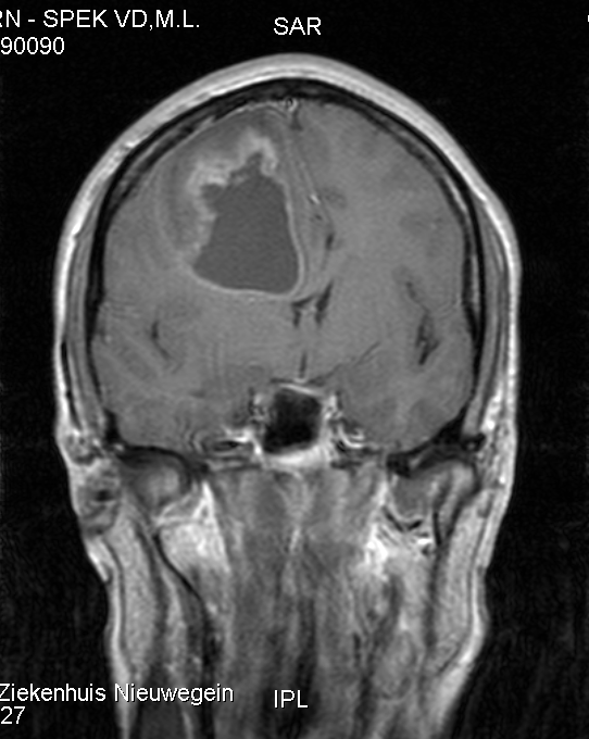 MRI van achteren, 27-11-2007